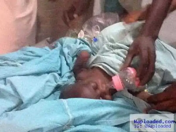 Photo: Baby Buhari whose penis was cut off by stepmother undergoes successful operation 